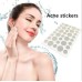 Пластырь от бородавок, папиллом и натоптышей 72 шт Acne Patch