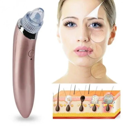 Аппарат для вакуумной чистки лица Beauty Skin Care Specialist XN-8030 Pink